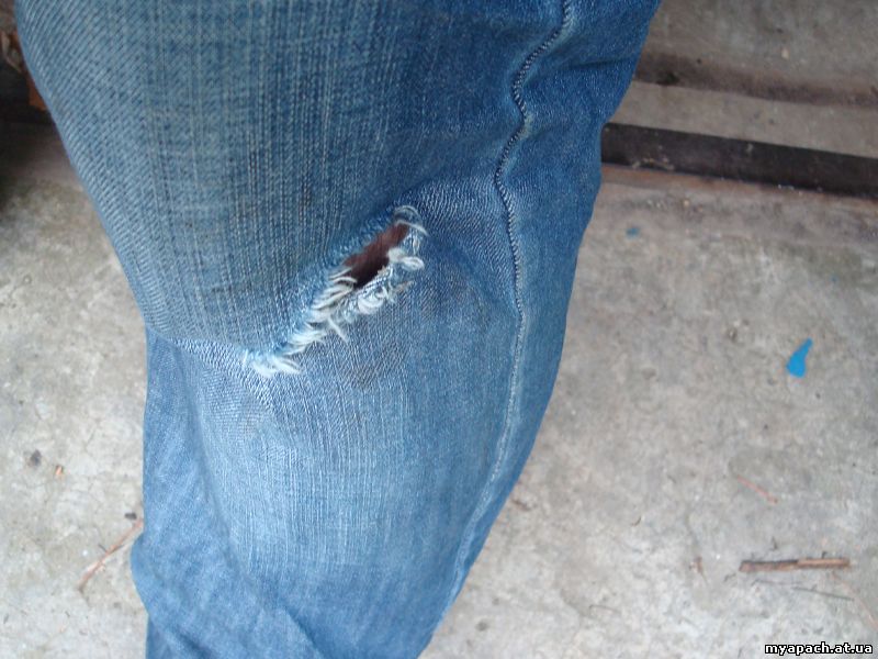 Порвані штани - результат рандеву з дворнягами та падіння